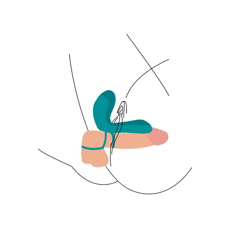 Grüner Paar-Vibrationsring