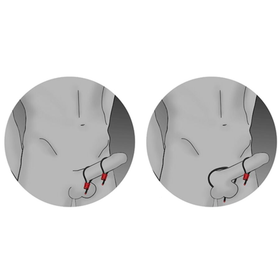ELECTRASTIM - PRESTIGE ELECTRA LOOPS VERSTELLBARE ROTE PENISRINGE